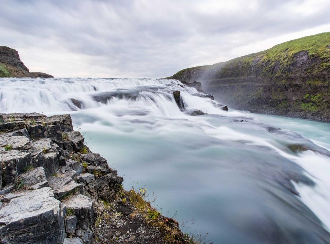 Exploring Your Options: From Support to Surgery